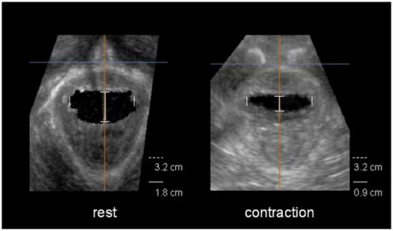 Fig. 5