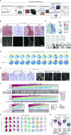 Figure 1. Quantitative single-cell analysis of MYC, BCL2, and BCL6 protein expression in B cells in nonmalignant tissues and diffuse large B-cell lymphoma. A, Schematic workflow of a quantitative digital pathology experiment. B, Spectrally unmixed multiplexed fluorescent images for CD20, MYC, BCL2, and BCL6 and nuclear counterstaining in tonsil tissue. The germinal center (GC) and extragerminal center (extra-GC) zones are indicated. C, Spatial map of MYC/BCL2/BCL6 subpopulations, i.e., possible permutations of MYC/BCL2/BCL6-positivity and -negativity within the CD20-positive cell population in a tonsil image. D, Quantitation of subpopulation extent within CD20-positive cells in tonsils and reactive lymph nodes resolved spatially between the GC and extra-GC zones. E, Example of pseudocolored MYC/BCL2/BCL6/CD20 mfIHC staining in diffuse large B-cell lymphoma (DLBCL; left). Cell segmentation and single oncogene positivity masks are shown within the CD20-positive cell population (right). F, Summary of percentage extent of subpopulations across patients from National University Hospital (NUH), Chi-Mei Medical Center (CMMC), MD Anderson (MDA), and Singapore General Hospital (SGH). Relevant clinicopathologic features are indicated; see also Supplementary Fig. S3. Patients were ordered arbitrarily according to extent of the triple-positive M+2+6+ subpopulation extent. IPI Risk Group, International Prognostic Index Risk Group; FISH, fluorescence in situ hybridization. G, Intrapatient spatial stability of subpopulations – proportion of subpopulations measured across four spatially distinct biopsies from the same patient (rows). Biopsy comparison overview is shown across 11 representative example DLBCL patients (columns). See also Supplementary Fig. S4A and S4B for a correlation analysis for all patients with multiple biopsies available. H, Proliferation analysis (i.e., Ki-67-positivity) among subpopulations in DLBCL samples. Proliferative BCL6-positive subpopulations are grouped. Median with interquartile range, whiskers denote 10th and 90th percentile. Mann–Whitney test (BCL6-positive vs. -negative subpopulations). All scale bars, 100 μm.