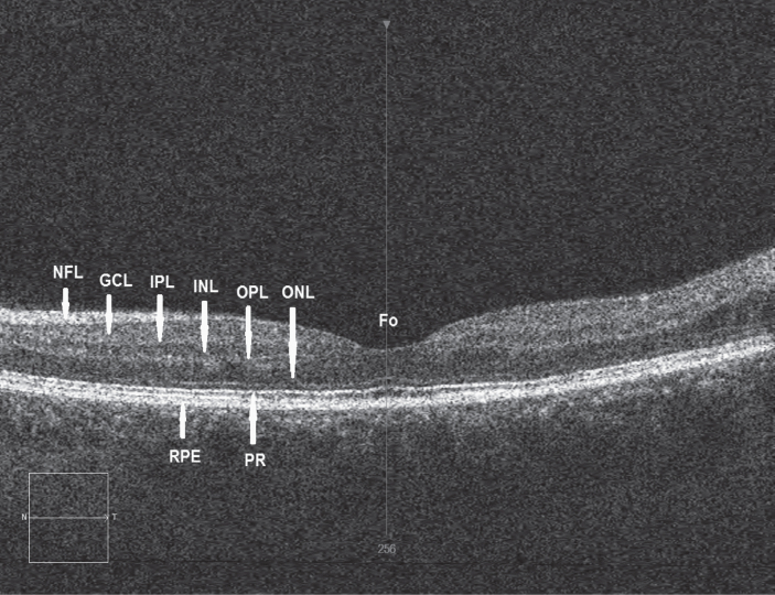 Fig.1