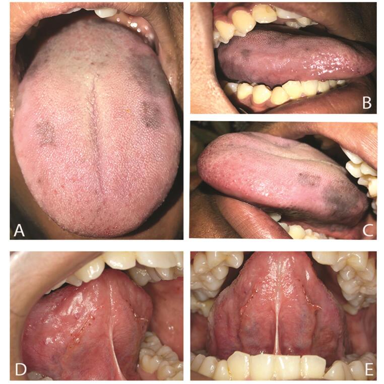 Fig. 1