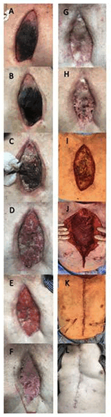 Figure 11