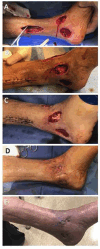 Figure 10