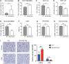 Figure 4. Mir4435-2hg depletion leads to increased tumor-infiltrating PMN-MDSCs and decreased T cells. Flow cytometry of tumor-infiltrating total neutrophils (A), CD14+ PMN-MDSCs (B), CD3+ T cells (C), CD8+ T cells (D), monocytes/M-MDSCs (E), total CD45+ cells (F), macrophages (G), and M2 macrophages (H) in subcutaneous MC38 tumors, n = 3–8/group. Data are representative of three independent experiments. I, Left, representative IHC of tumor-infiltrating PMN-MDSCs (S100a8) and CD8+ T cells (CD8) in the long-term AOM/DSS model. Scale bar, 100 μm. Right, quantification, n = 5/group. Data are presented as mean ± SD; statistical significance was assessed by an unpaired t test (ns, P > 0.05; *, P < 0.05; **, P < 0.01; ***, P < 0.001).