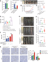 Figure 6. Neutrophil-specific deletion of Mir4435-2hg promotes colorectal cancer progression. A, Relative Mir4435-2hg expression in neutrophils and intestinal epithelial cells from naïve 8-week Mir4435-2hgflox/flox, Mir4435-2hgflox/flox Villin-Cre, and Mir4435-2hgflox/flox S100a8-Cre mice, n = 2–3/group. B, Tumor growth curves for the subcutaneous MC38 colorectal cancer model, n = 8/group, tumors were harvested at day 22. C, Tumors from Mir4435-2hgflox/flox and Mir4435-2hgflox/flox S100a8-Cre mice from B. D, Quantification of tumor weight from mice in B. E, Flow cytometry of lipid accumulation of splenic neutrophil from tumor-free or subcutaneous MC38 tumor-bearing Mir4435-2hgflox/flox and Mir4435-2hgflox/flox S100a8-Cre mice, n = 5/group. F, Lipid accumulation in the bone marrow-derived PMN-MDSCs form the indicated mice with/without MC38 culture medium (CM), n = 3/group. G, Gross view of colorectum from Mir4435-2hgflox/flox, Mir4435-2hgflox/flox Villin-Cre, and Mir4435-2hgflox/flox S100a8-Cre mice in AOM/DSS model, n = 6/group. H, Quantification of tumor number from mice in (G); each spot represents one mouse. I, Quantification of tumor size from mice in G; each spot represents one tumor. J, Quantification of tumor burden from mice in G; each spot represents one mouse. K, Left, representative IHC of tumor-infiltrating PMN-MDSCs (S100a8) and CD8+ T cells (CD8). Scale bar, 100 μm. Right, quantification, n = 5/group. (A, E, and F) Data are representative of three independent experiments. Data are presented as mean ± SD; statistical significance was assessed by an unpaired t test (ns, P > 0.05; *, P < 0.05; **, P < 0.01; ***, P < 0.001; ****, P < 0.0001).
