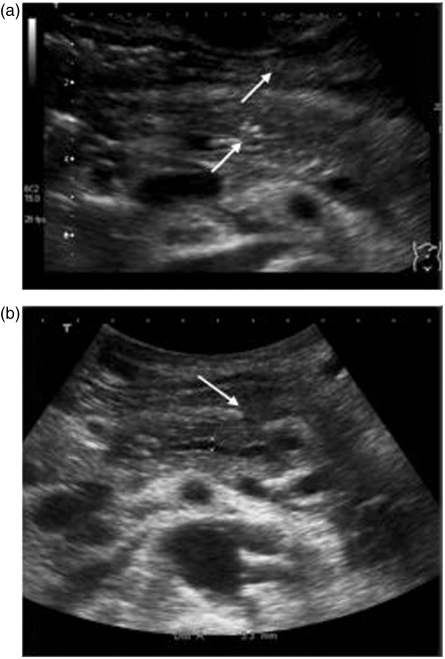 Figure
                                3.