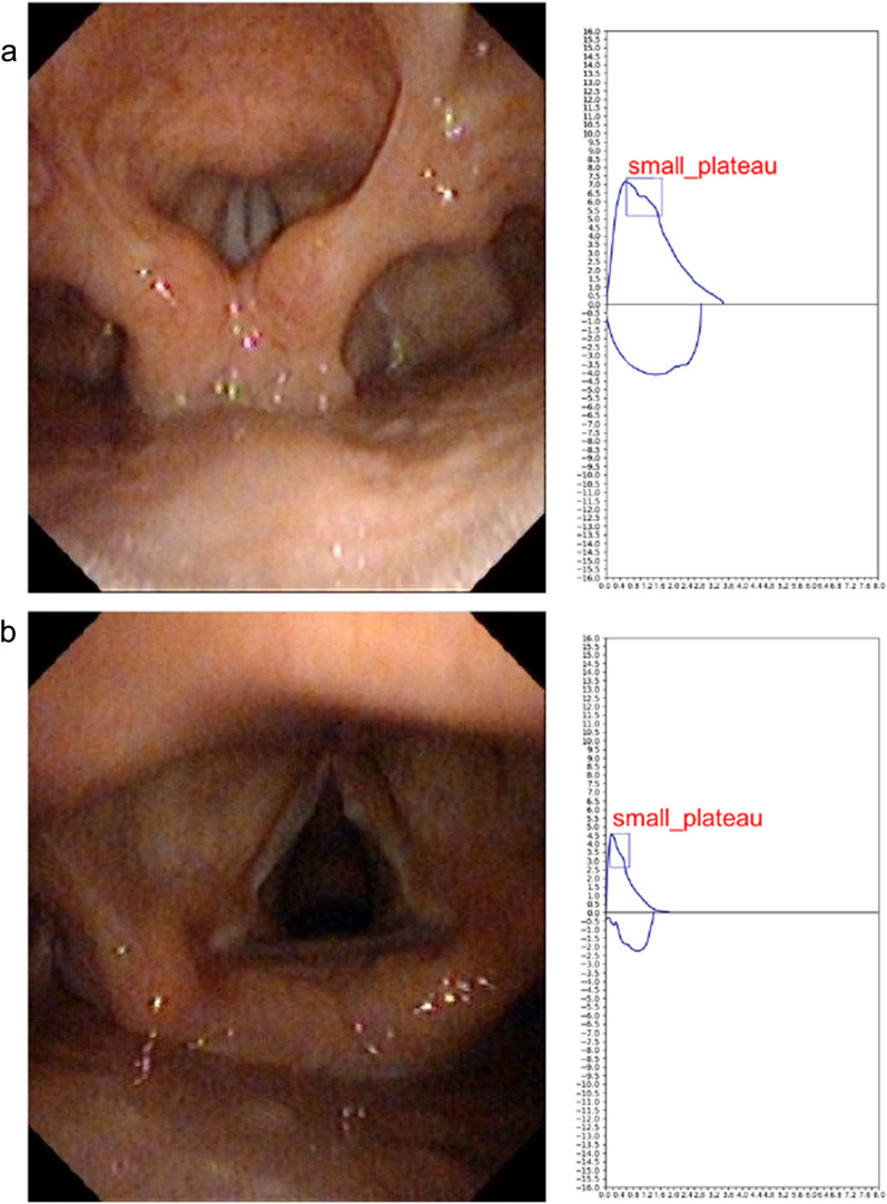 Fig. 8