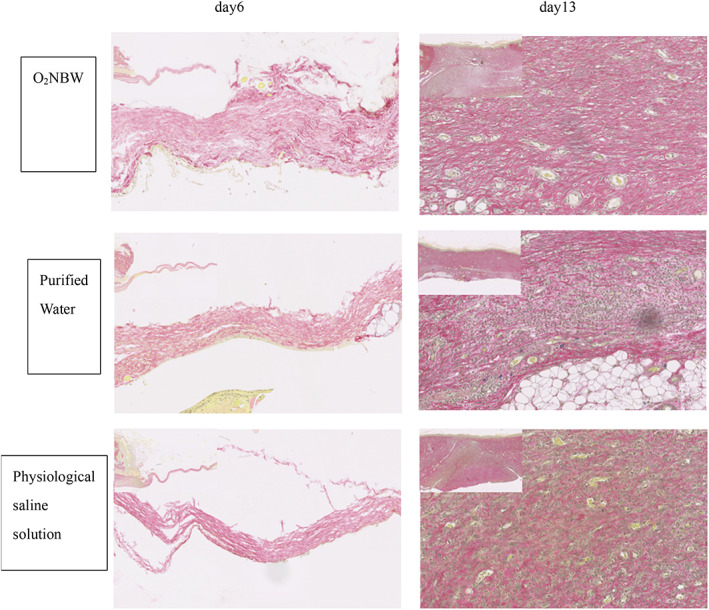 FIGURE 11