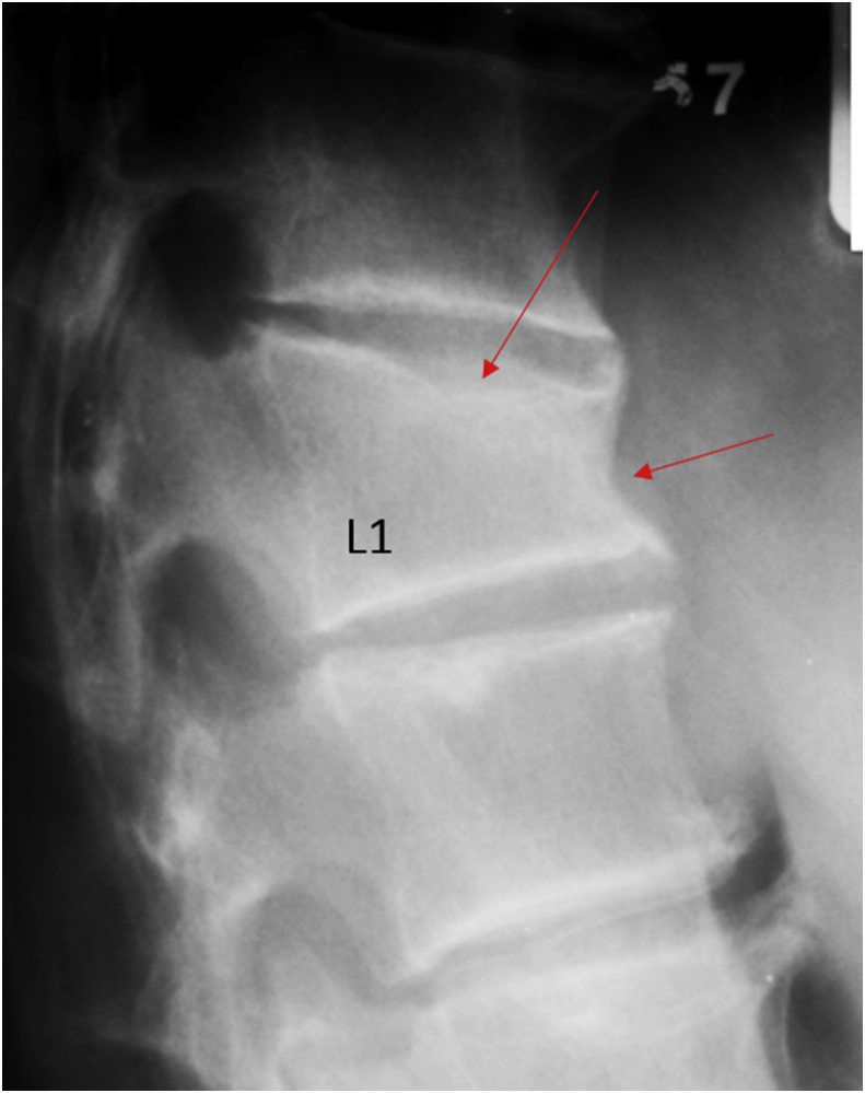 Figure 3