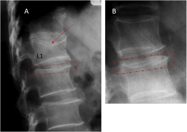 Figure 2