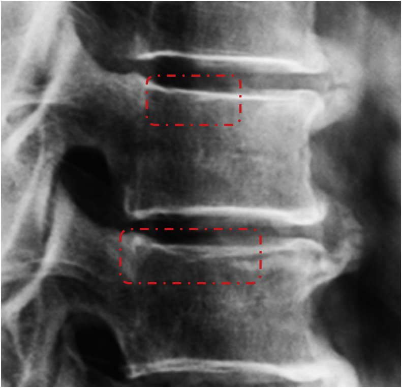 Figure 18