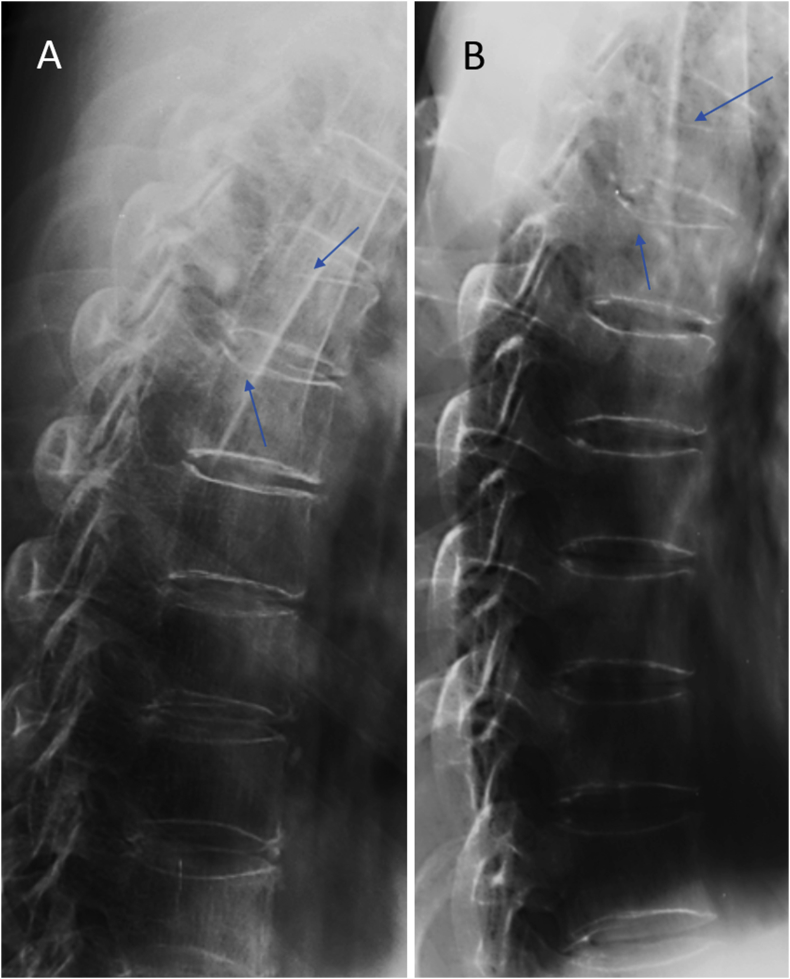 Figure 23