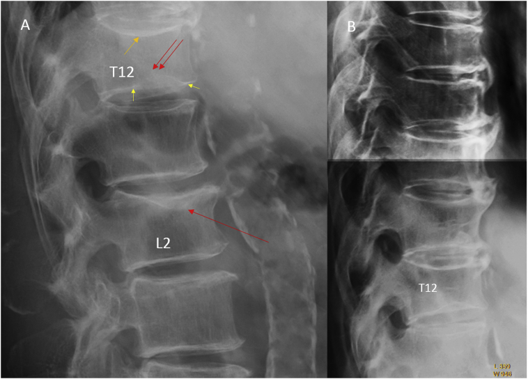 Figure 6