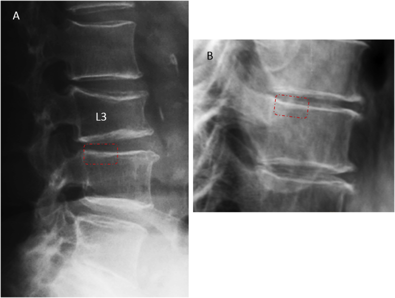 Figure 16