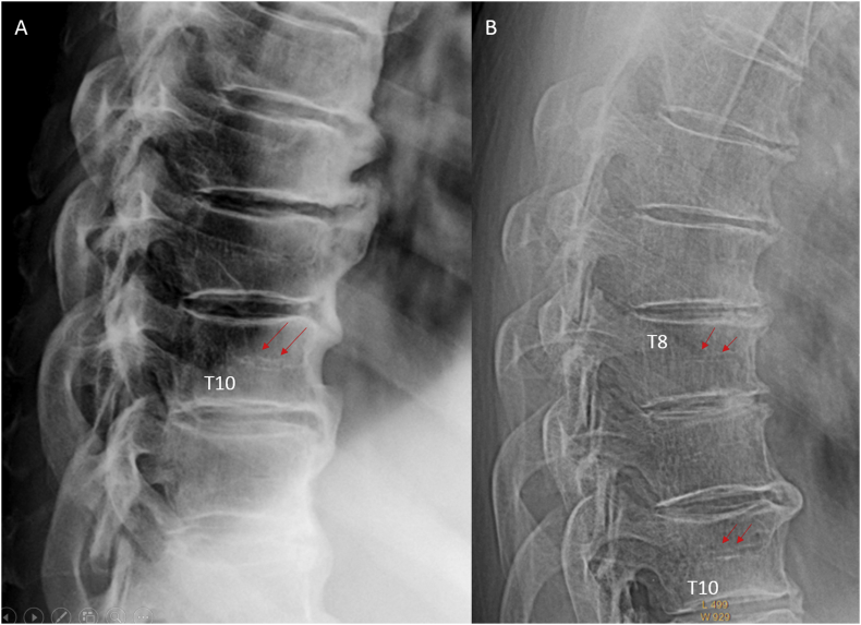 Figure 24