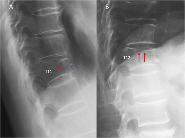 Figure 12