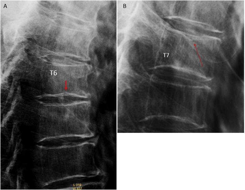 Figure 4