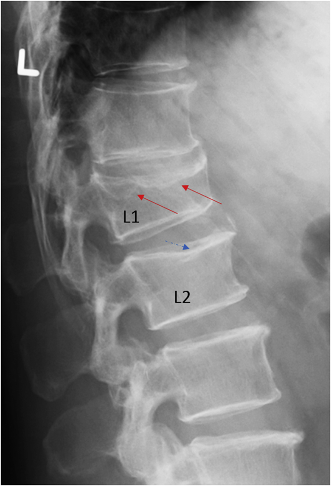 Figure 14