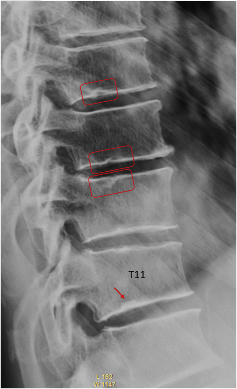 Figure 20