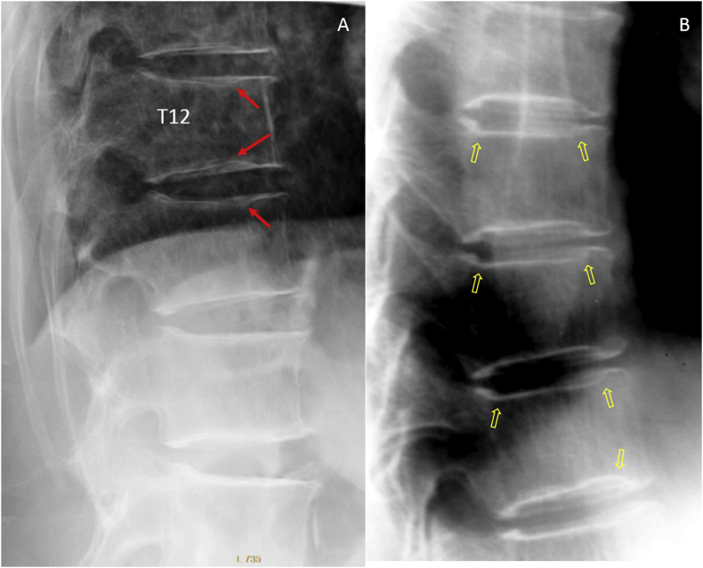 Figure 17