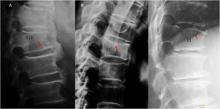 Figure 11