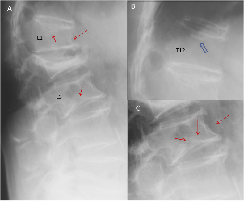 Figure 13