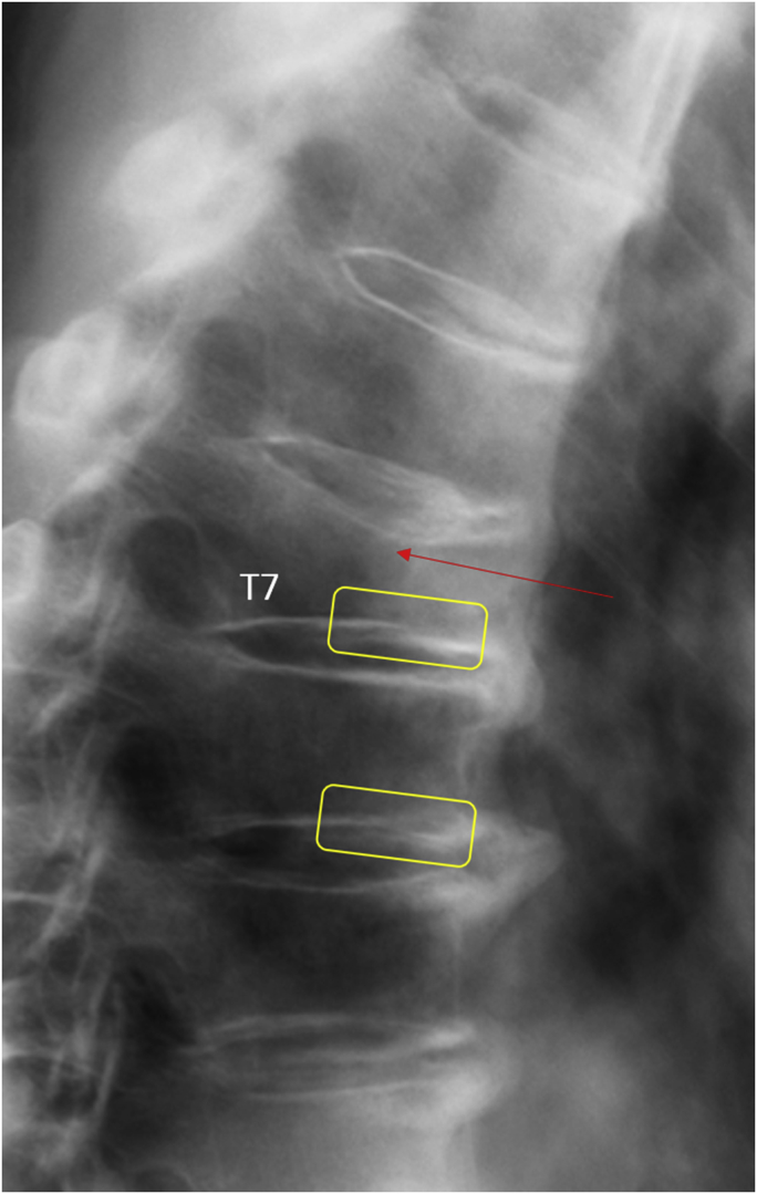 Figure 5