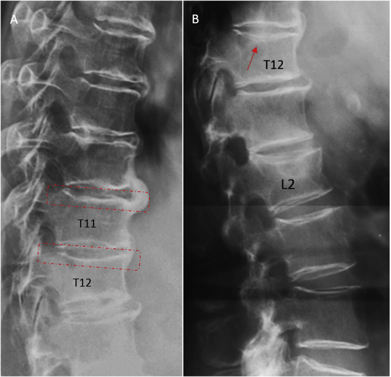 Figure 22