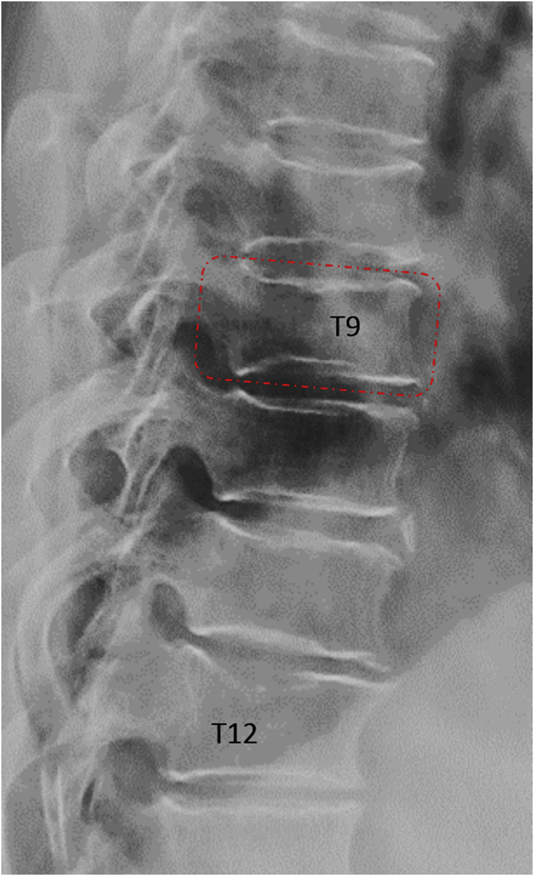 Figure 15