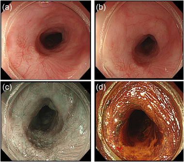 FIGURE 1