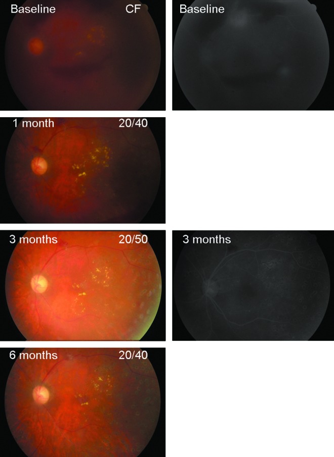 FIG. 2.