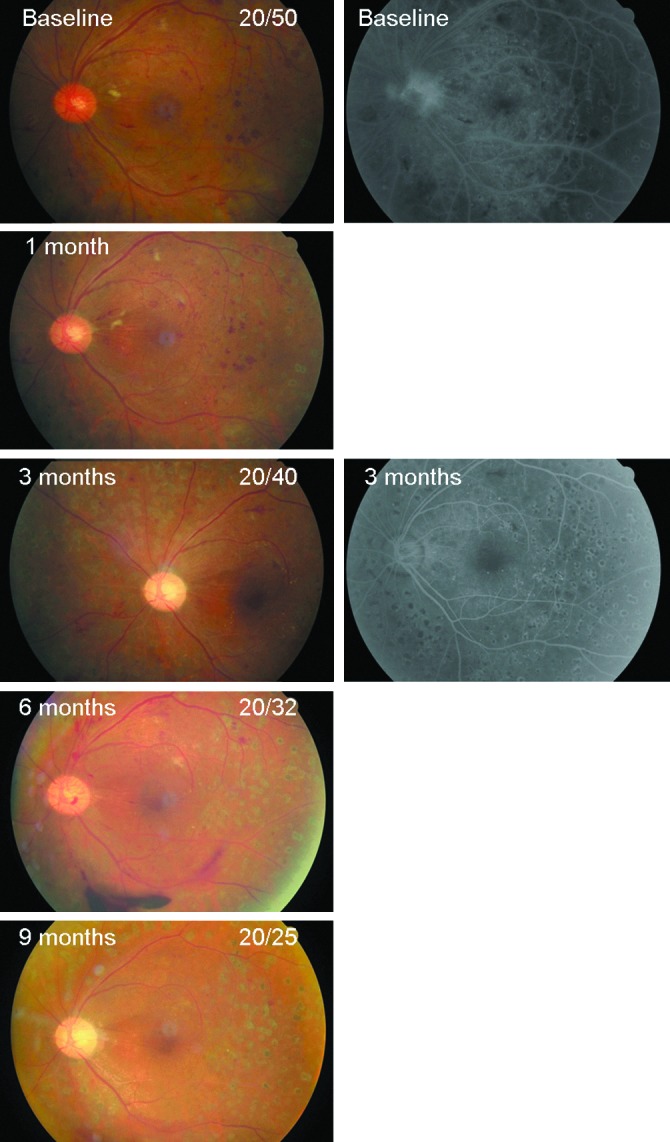 FIG. 3.