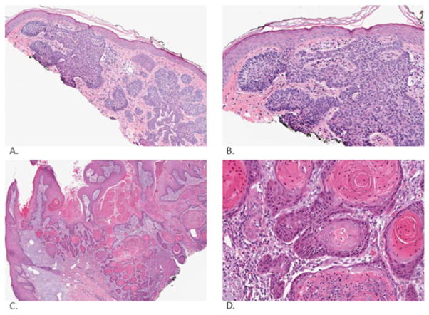 Fig. (1)