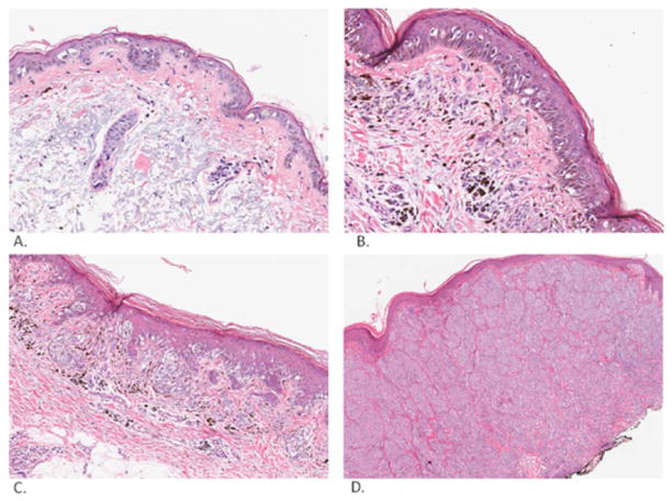 Fig. (2)