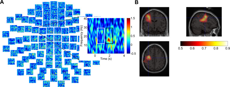 Figure 5—figure supplement 1.