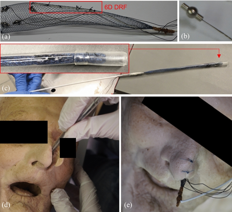 Fig. 2