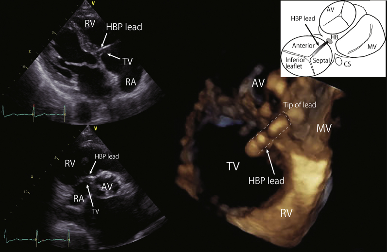 Figure 1