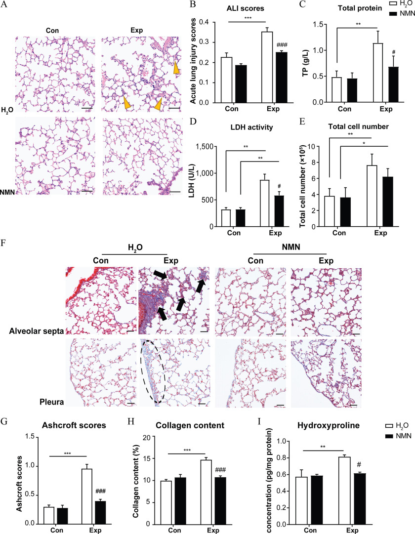 Figure 3A is a stained tissue displaying two columns, namely, air-filtered control group and PM exposure group and two rows, namely, water and nicotinamide mononucleotide. Figures 3B, 3C, 3D, 3E, 3G, 3H, and 3I are bar graphs titled Acute lung injury scores, Total protein, Lactate dehydrogenase activity, Total cell number, Ashcroft scores, Collagen content, Hydroxyproline, plotting Acute lung injury scores, ranging from 0.0 to 0.4 in increments of 0.1; total protein (gram per liter), ranging from 0.0 to 1.5 in increments of 0.5; lactate dehydrogenase, ranging from 0 to 1,500 in increments of 500; total cell number (times 10 begin superscript 5 end superscript), ranging from 0 to 10 in increments of 2; Ashcroft scores, ranging from 0.0 to 1.5 in increments of 0.5; collagen content (percentage), ranging from 0 to 20 in increments of 5; concentration (picograms per milligram protein), ranging from 0.0 to 1.0 in increments of 0.2 (y-axis) across concentration and exposure (x-axis) for water and nicotinamide mononucleotide, respectively. Figure 3F is a set of two stained tissues that displays four columns, namely, air-filtered control group and PM exposure group for water and air-filtered control group and PM exposure group for nicotinamide mononucleotide, and two rows, namely, alveolar septa and pleura.