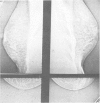 54