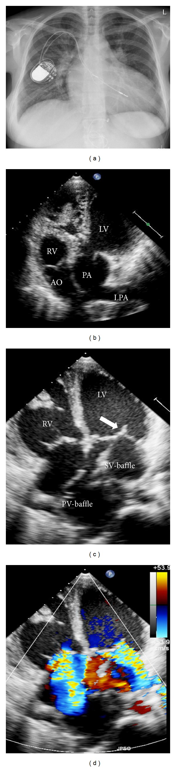 Figure 4