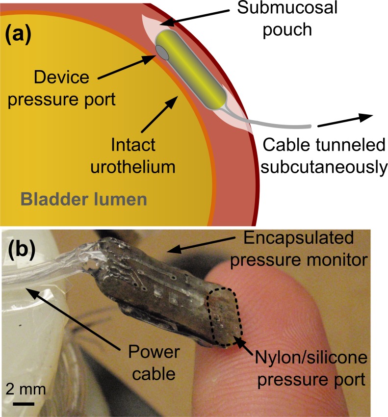 Fig 1