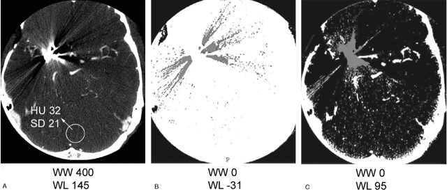 Fig 3.