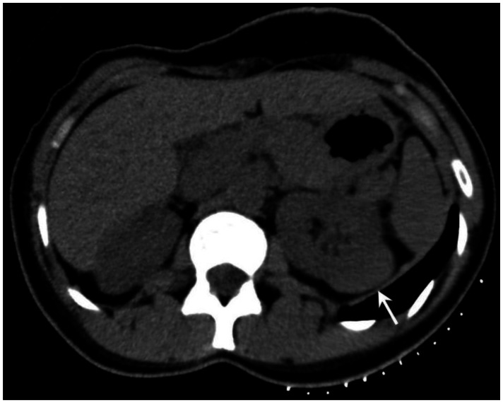 Figure 9