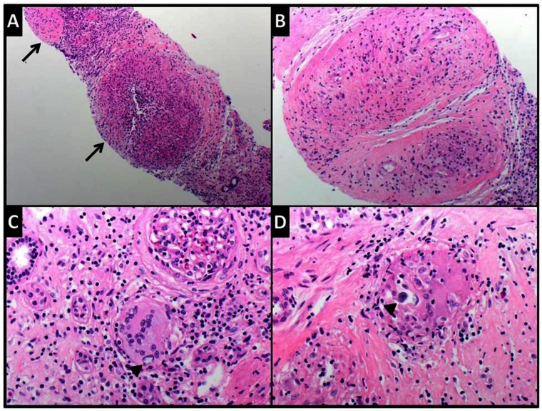 Figure 13