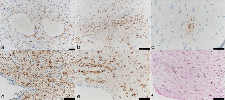 Fig. 11