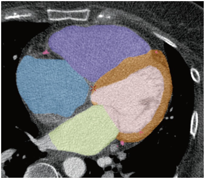 Fig. 1