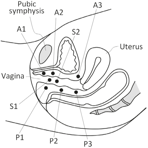 Figure 2.-