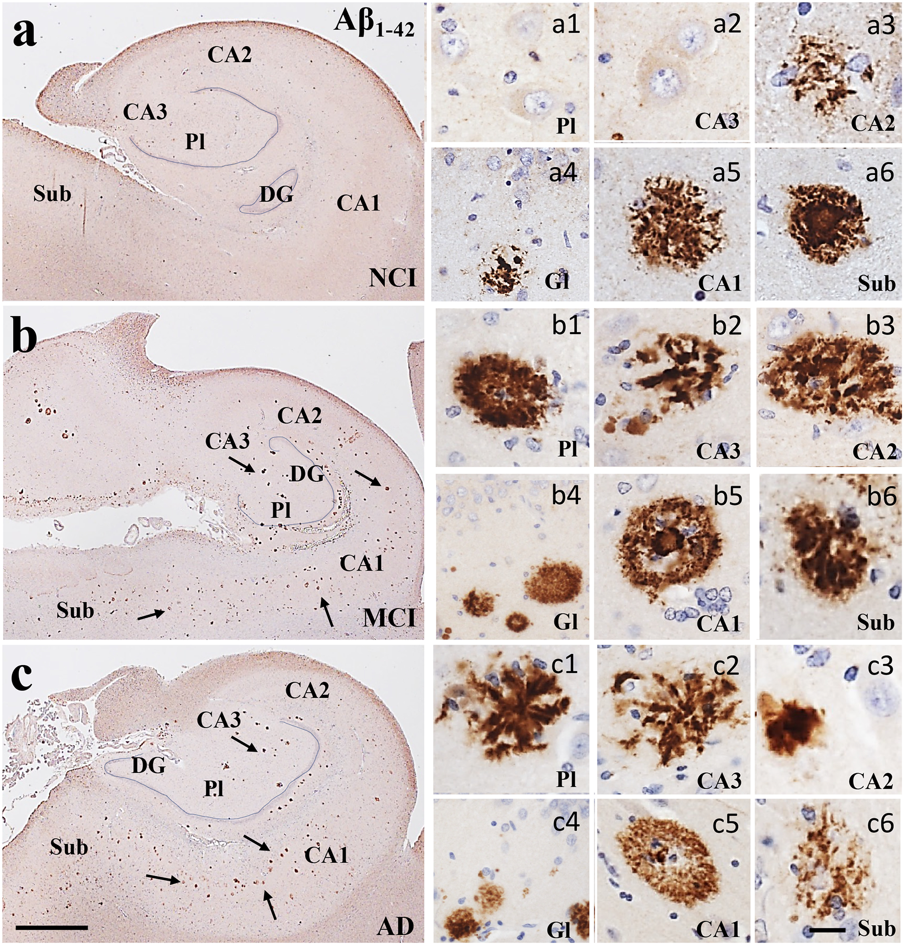 Figure 11.