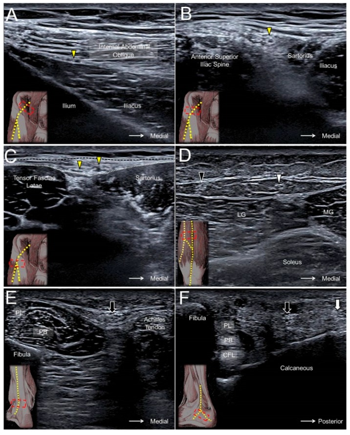 Figure 11