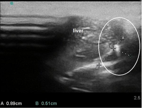 Figure 10