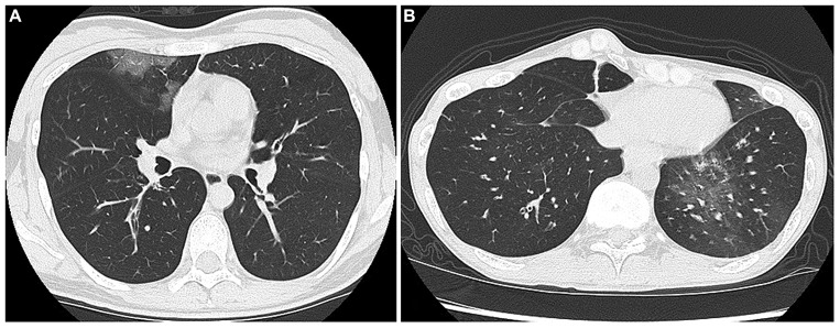 FIGURE 2